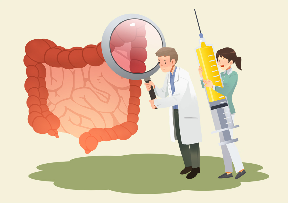 사람보다 크게 표현된 대장을 의사가 돋보기로 비춰 보고 있고, 그 뒤에 간호사가 사람만한 약물이 들어있는 주사기를 세워서 들고 있는 일러스트 이미지