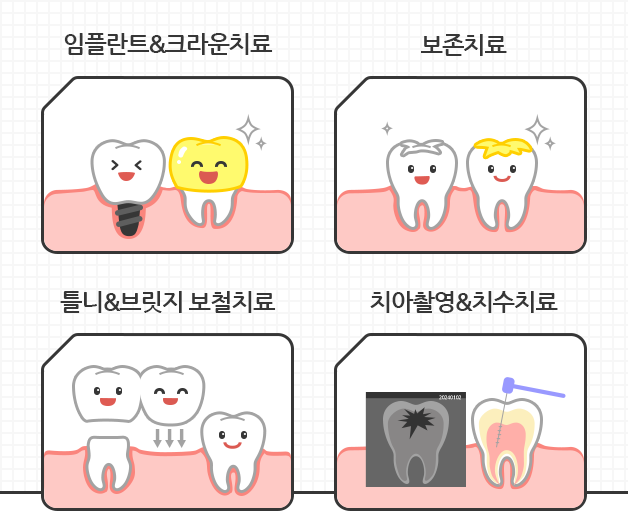 임플란트&크라운치료, 보존치료, 틀티&브릿지 보철치료, 치아촬영&치수치료가 보장됨을 보여주는 이미지